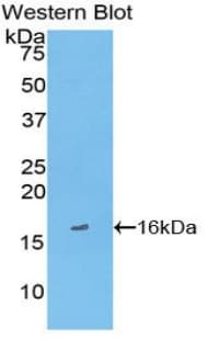 FABP3 / H-FABP Antibody (aa1-133, APC)