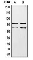 Polyclonal Rabbit anti-Human CHAT Antibody (Internal, WB)