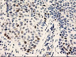 UNG / Uracil DNA Glycosylase Antibody (clone OTI1A11)