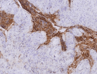 CEACAM5 / CD66e Antibody (clone CB30)