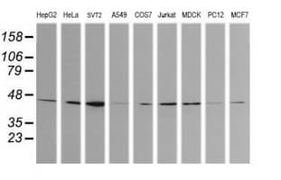 CALR3 Antibody (clone OTI1E1)
