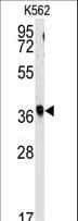 RFC2 / RFC40 Antibody (aa17-46)
