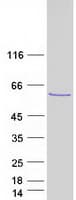 Human TBL1Y / TBL1 Protein (Recombinant Myc-DDK (Flag))