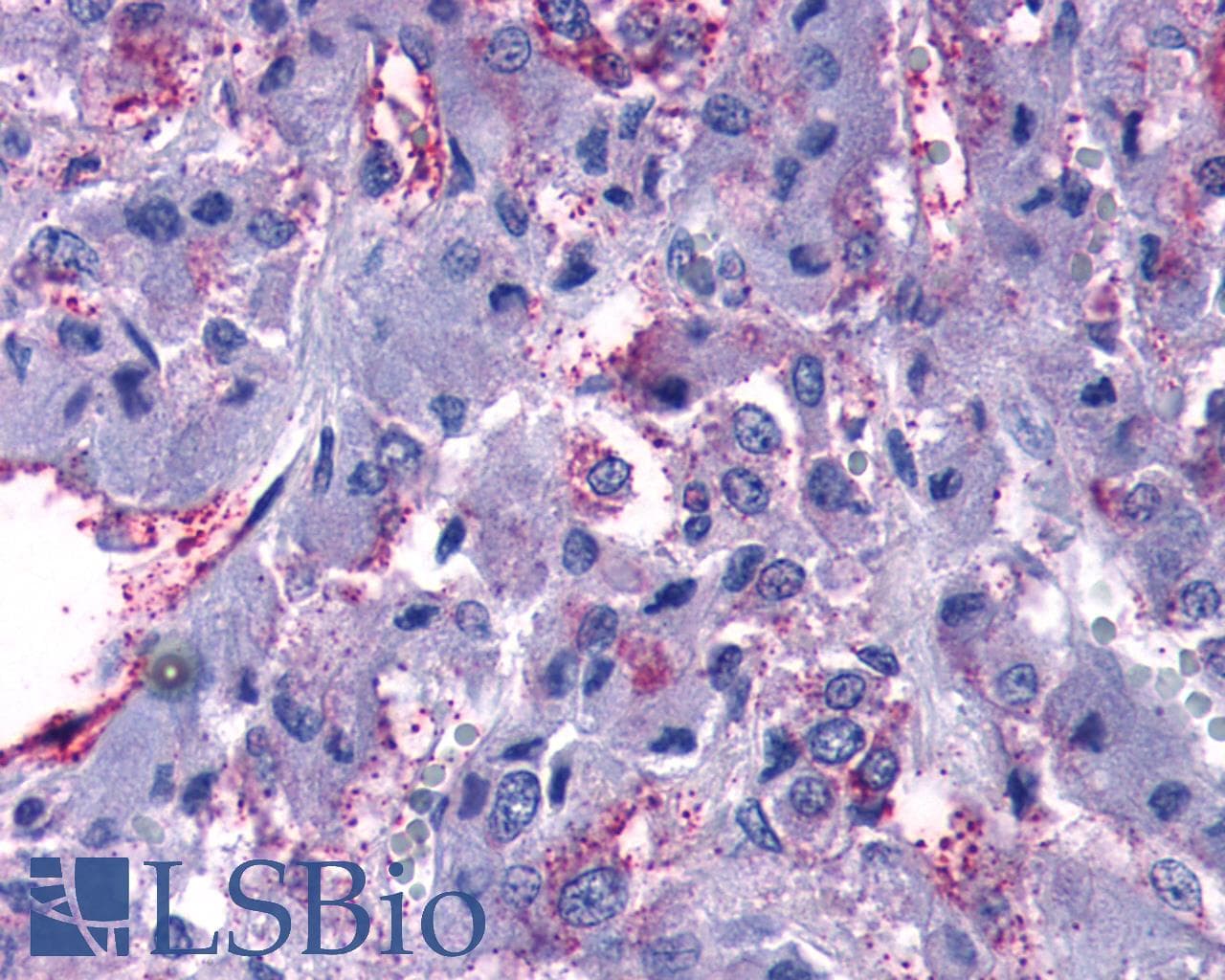 PathPlus™ GPR108 Antibody (Cytoplasmic Domain)