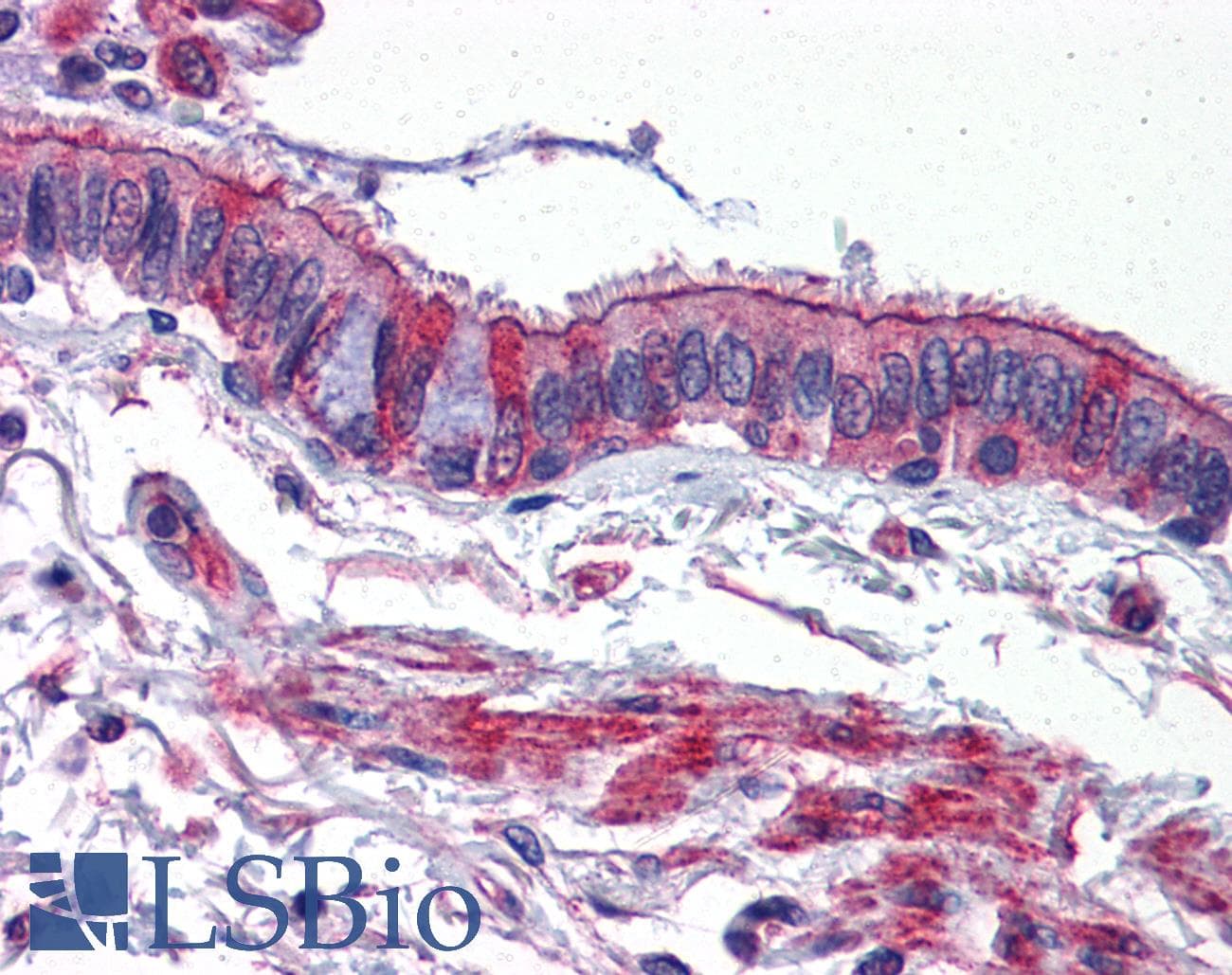 IHC-plus™ Polyclonal Rabbit anti-Human ACVR1B / ALK4 Antibody (IHC, WB)
