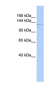 PHF2 Antibody (aa936-985)