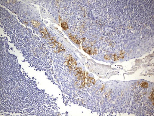 CD274 / B7-H1 / PD-L1 Antibody (aa19-290, clone UMAB229)