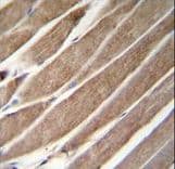 Polyclonal Rabbit anti-Human ATG4D Antibody (aa42-71, IHC, IF, WB)