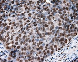 XRCC1 Antibody (clone OTI2F8)