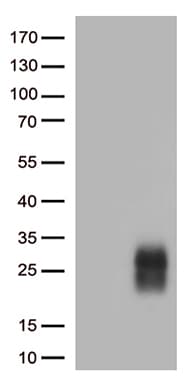 CTLA4 / CD152 Antibody (clone OTI3A5)