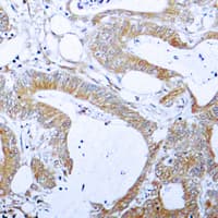 BCL2L1 / BCL-XL Antibody (phospho-Thr47)