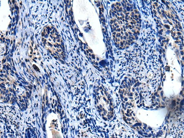 TRIM23 Antibody