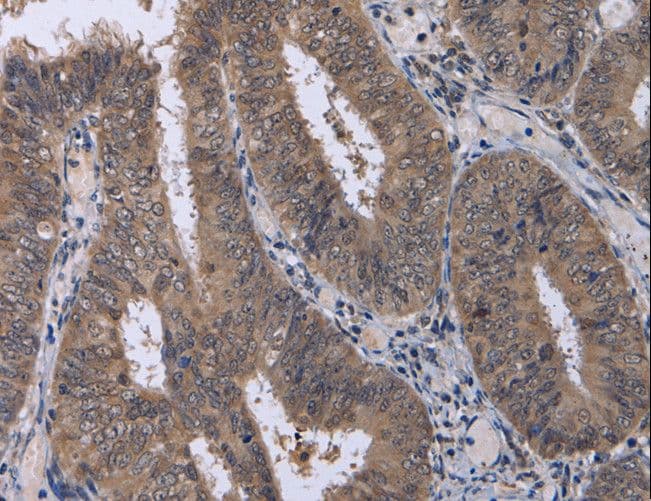 CDK5 Antibody