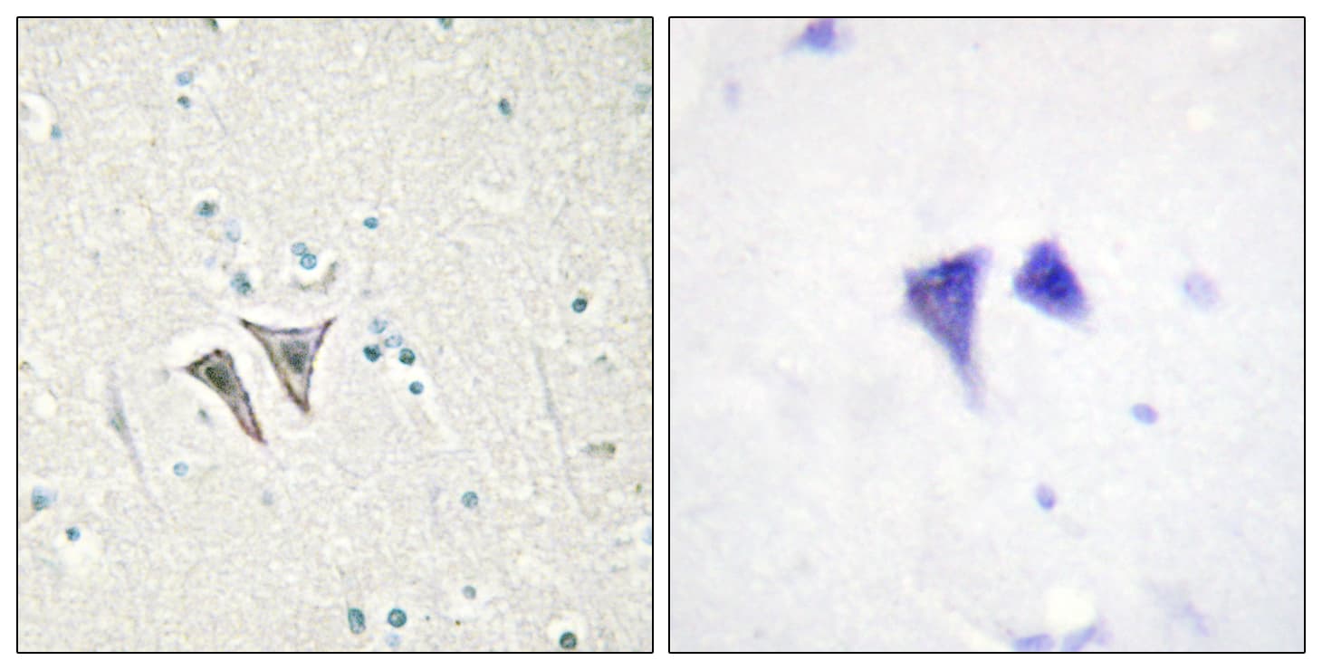 ACVR1C / ALK7 Antibody (aa201-250)
