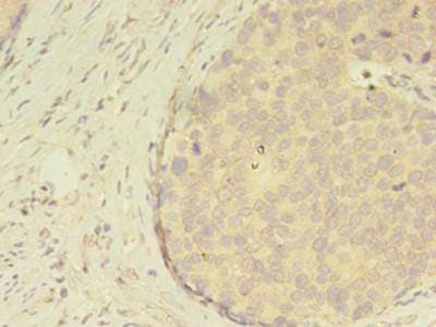 Polyclonal Rabbit anti-Human ATXN7L3 Antibody (IHC)