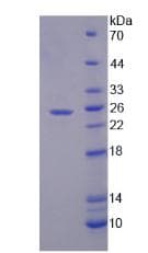 Human SPP2 Protein (Recombinant His, N-Terminal)