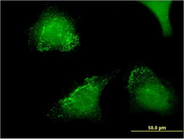 ACP5 / TRAP Antibody (clone 2D9)
