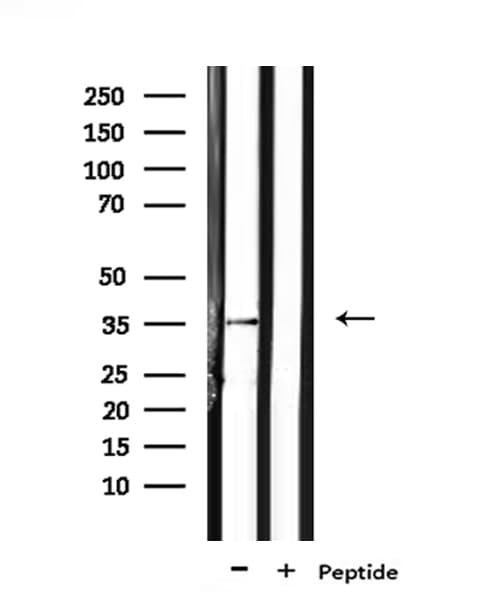 OR6N1 Antibody