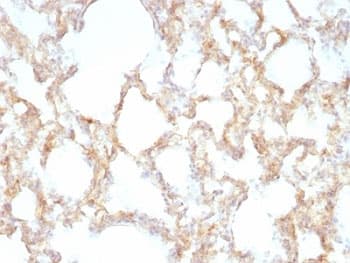 KRT7 / CK7 / Cytokeratin 7 Antibody (clone KRT7/1198)