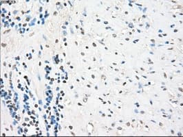 PPP5C Antibody (clone OTI6C2)