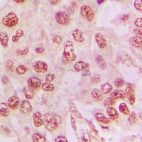 Polyclonal Rabbit anti-Human LGALS3 / Galectin 3 Antibody (Internal, IHC, IF, WB)