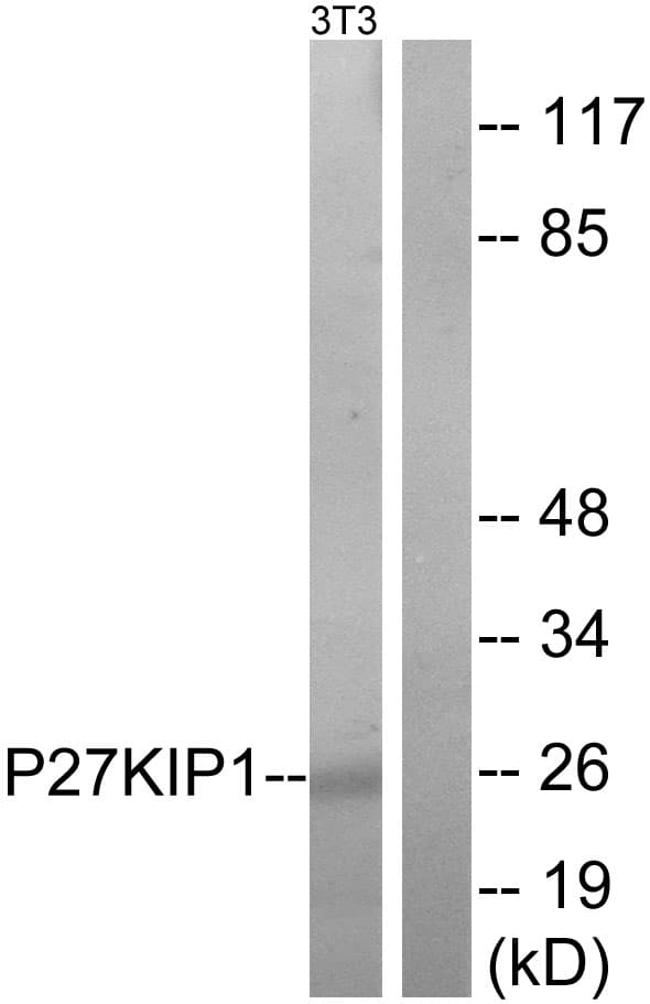Polyclonal Rabbit anti-Human CDKN1B / p27 Kip1 Antibody (aa141-190, WB)