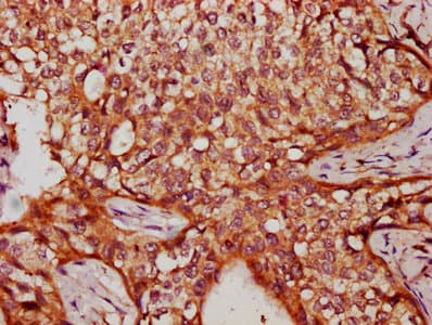 Polyclonal Rabbit anti-Human VARS2 / ValRS Antibody (IHC)
