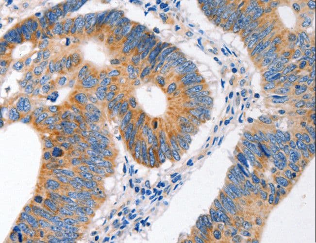 Polyclonal Rabbit anti-Human MC1R Antibody (IHC)