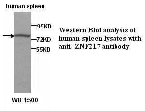 Polyclonal Rabbit anti-Human ZNF217 Antibody (WB)