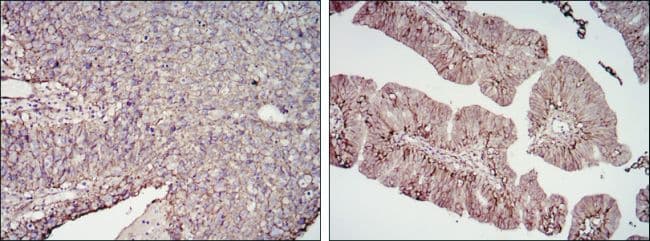 CD276 / B7-H3 Antibody (clone 6A1)