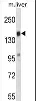 Polyclonal Rabbit anti-Human TIAM2 Antibody (aa357-385, WB)