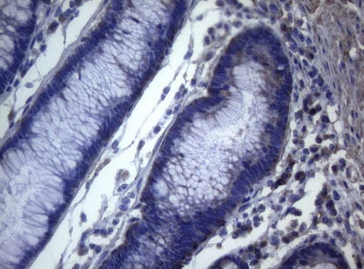 MAK Antibody (aa291-623, clone OTI5A7)