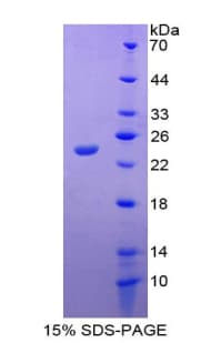 Rabbit IL18 Protein (Recombinant His-T7)