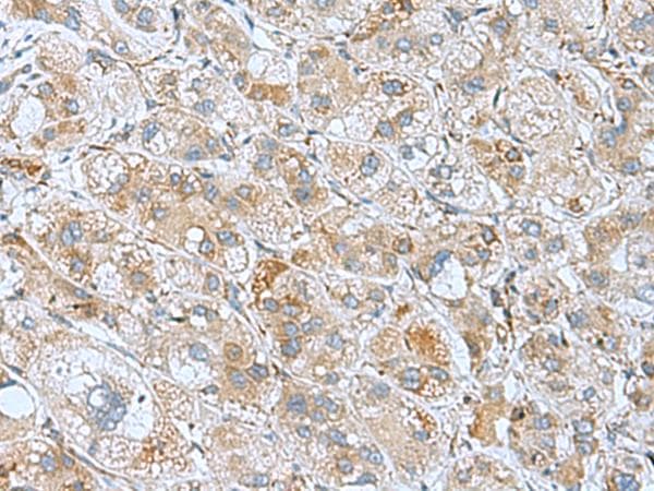 DHX58 / LGP2 Antibody