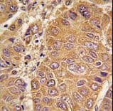 Polyclonal Rabbit anti-Human APOA1 / Apolipoprotein A 1 Antibody (aa10-37, IHC, WB)