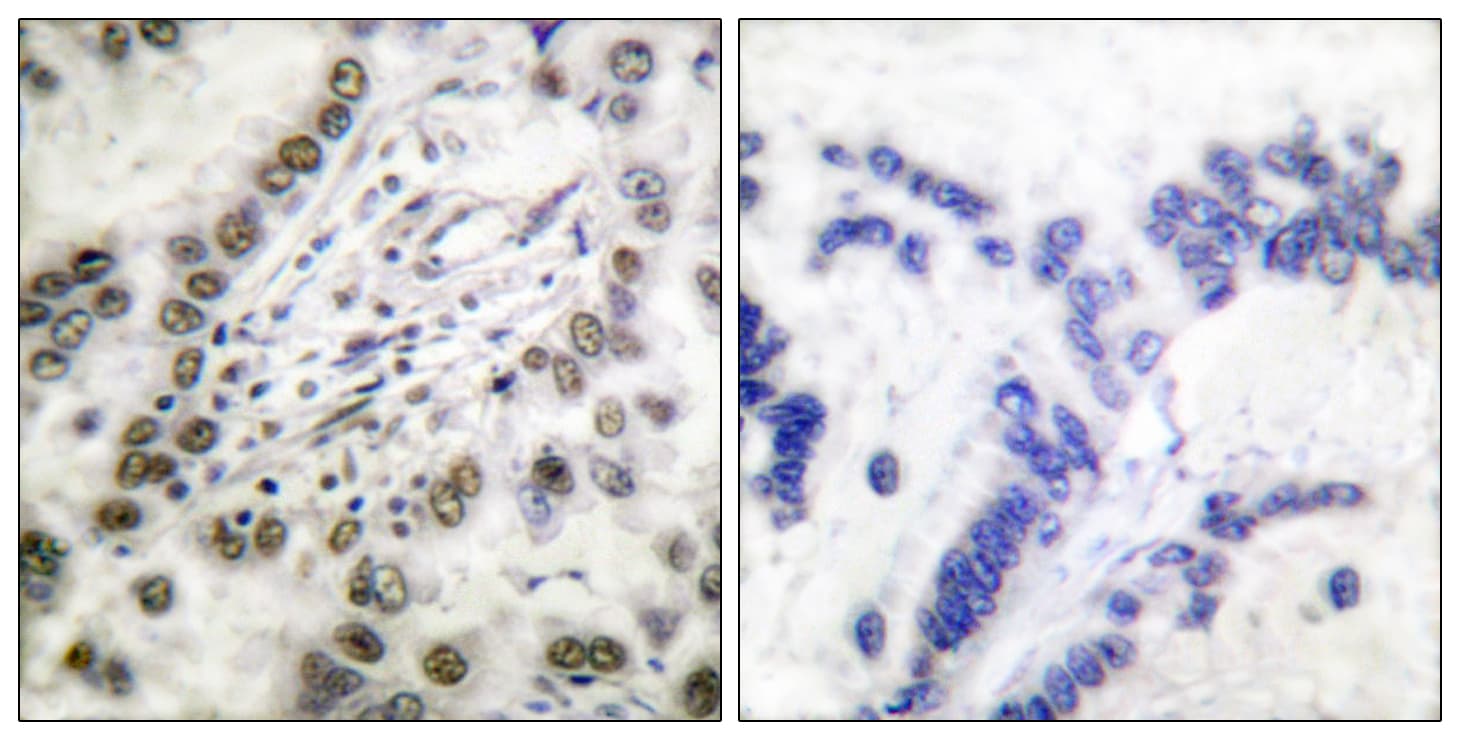 Polyclonal Rabbit anti-Human CREBBP / CREB Binding Protein Antibody (aa1501-1550, IHC, IF, WB)
