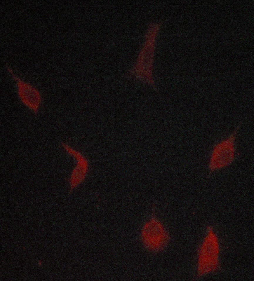 IHC-plus™ Polyclonal Rabbit anti-Human TGFBR1 / ALK5 Antibody (IHC, IF, WB)