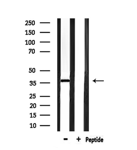 ANXA5 / Annexin V Antibody