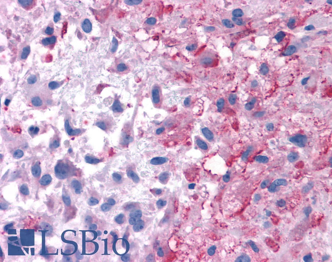 PathPlus™ P2RY14 / GPR105 Antibody (Extracellular Domain)