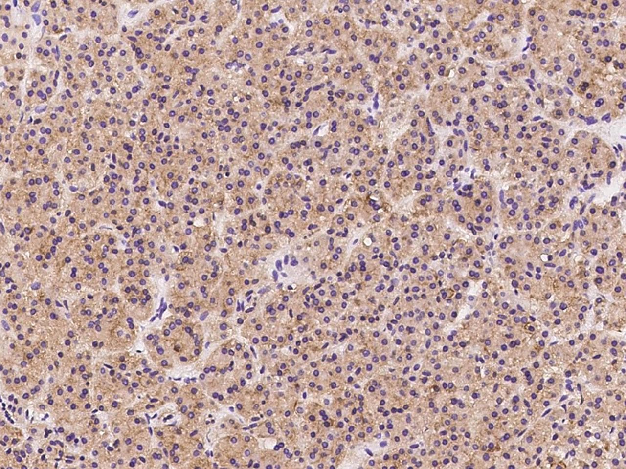 Polyclonal Rabbit anti-Human IKKe/IKKi/TBK1 Antibody (IHC)