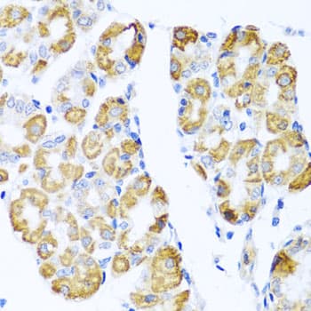 IHC-plus™ CCL17 / TARC Antibody