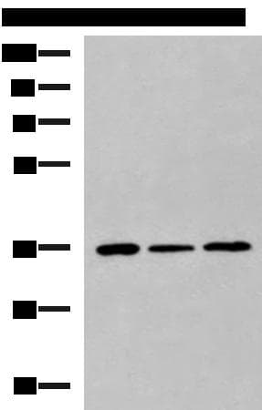 KHK / Ketohexokinase Antibody