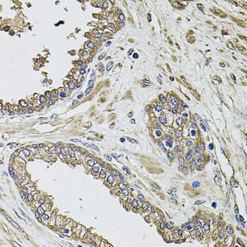 IHC-plus™ Polyclonal Rabbit anti-Human KCNK9 / TASK3 Antibody (IHC, WB)