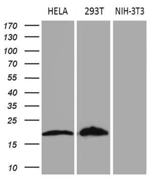 p16INK4a / CDKN2A Antibody (clone OTI10F12)