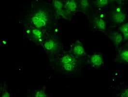 PPP5C Antibody (clone OTI2G2)