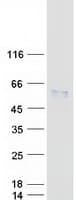 Human SERPINA7 / TBG Protein (Recombinant Myc-DDK (Flag))