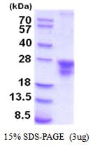 Human CD74 / CLIP Protein (Recombinant 6His, C-terminus)