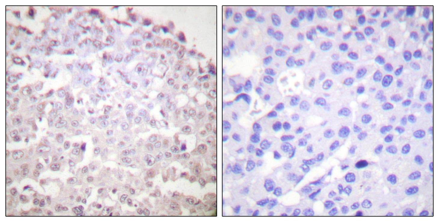 DDIT3 / CHOP Antibody