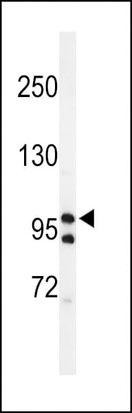Polyclonal Rabbit anti-Human TAF2 Antibody (aa1152-1180, IHC, WB)