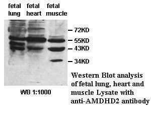 IHC-plus™ AMDHD2 Antibody (aa112-319)